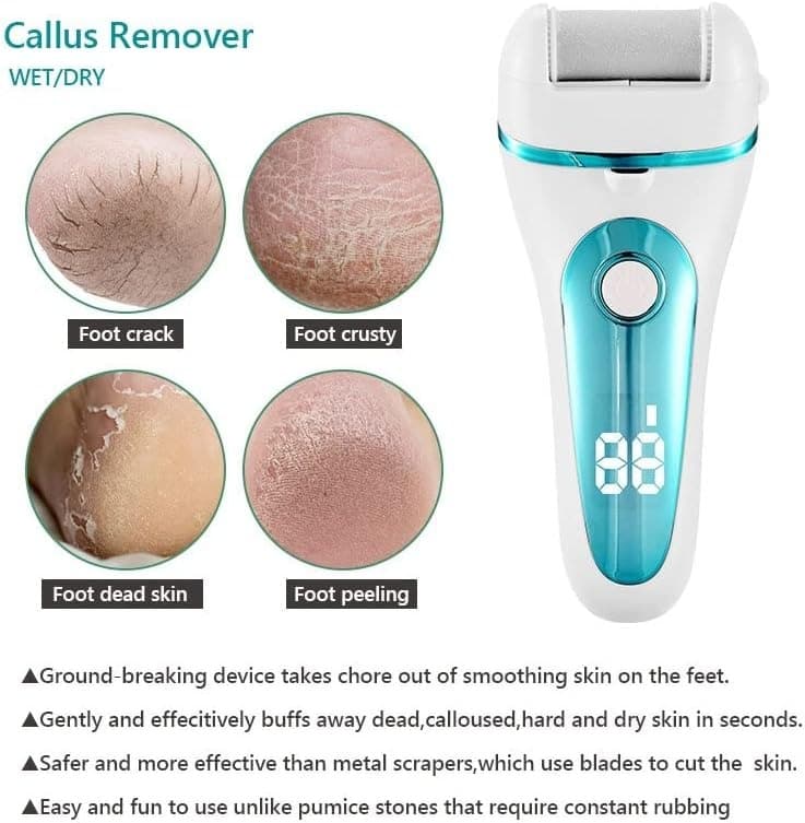 Electric Foot File & Callus Remover – Rechargeable Pedicure Tool