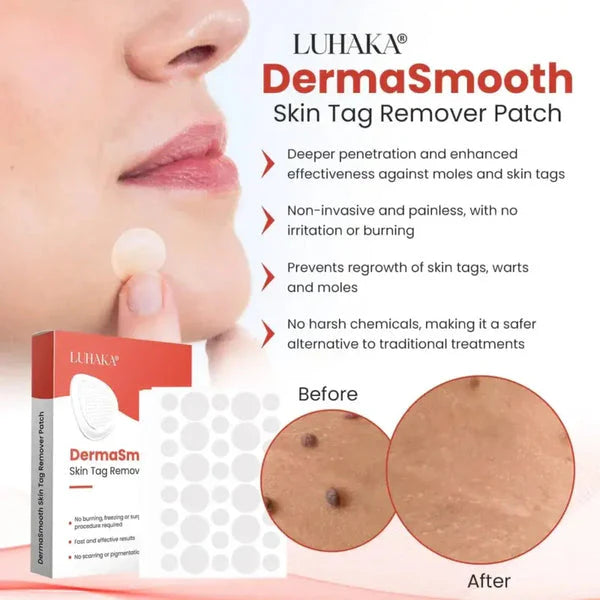 Acne Patches – 360pcs | Pimple Healing Spot Stickers