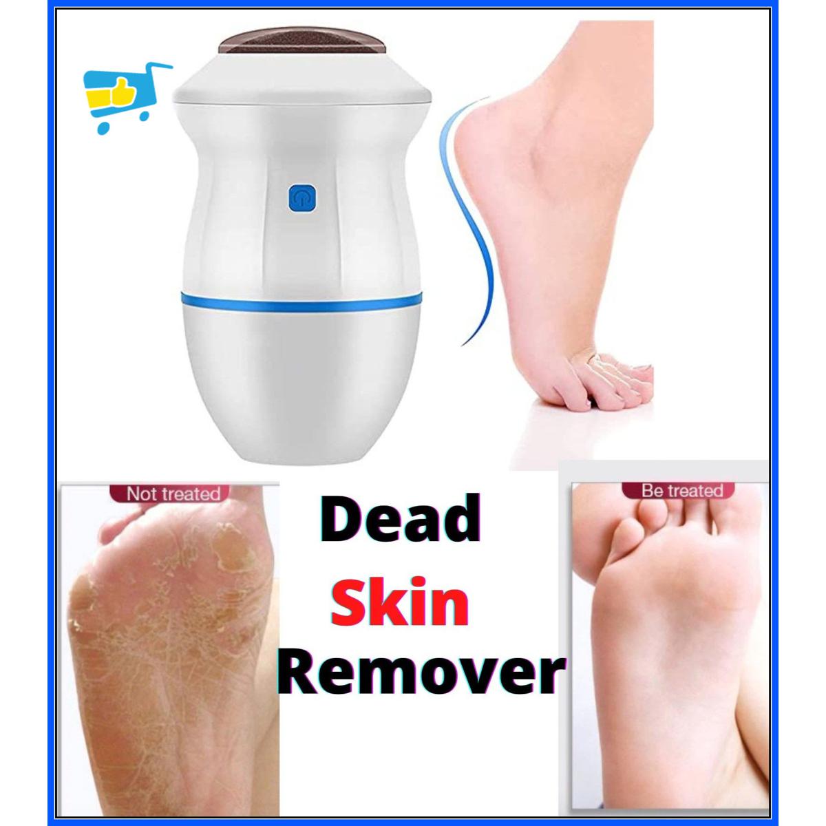 Electric Callus Remover – USB Rechargeable Foot Exfoliator for Smooth Feet