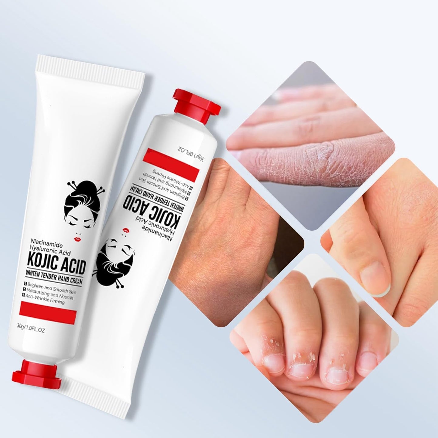 Sadoer Kojic Acid Hand Cream – Whitening, Brightening & Deep Moisturizing