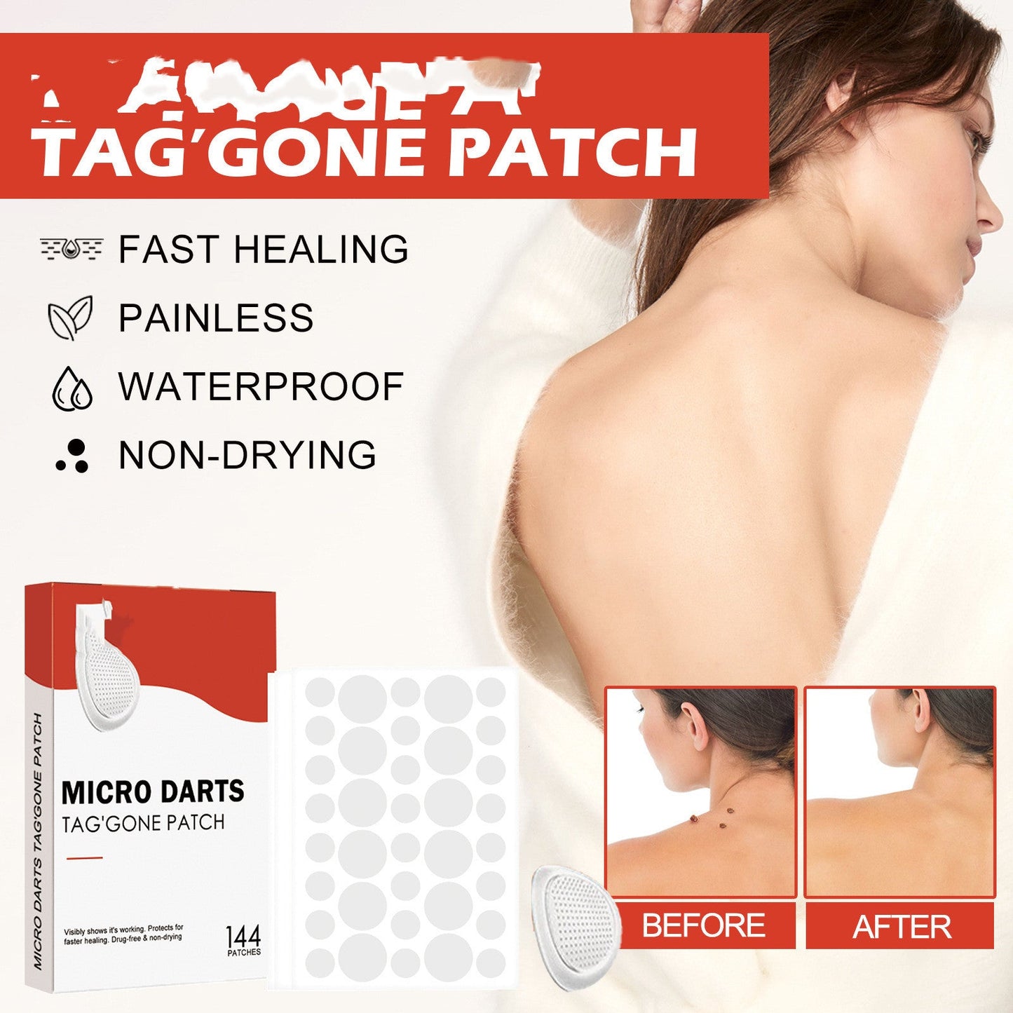 Acne Patch – Tea Tree & Calendula Acne Clearing Patches (144 Patches)