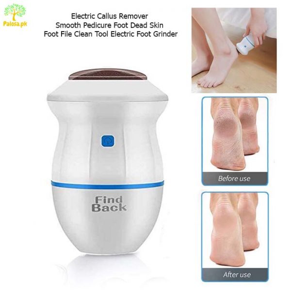 Electric Callus Remover – USB Rechargeable Foot Exfoliator for Smooth Feet