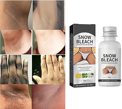Snow Bleach Intensive Cream – Dark Spot Remover & Skin Brightening 30ml