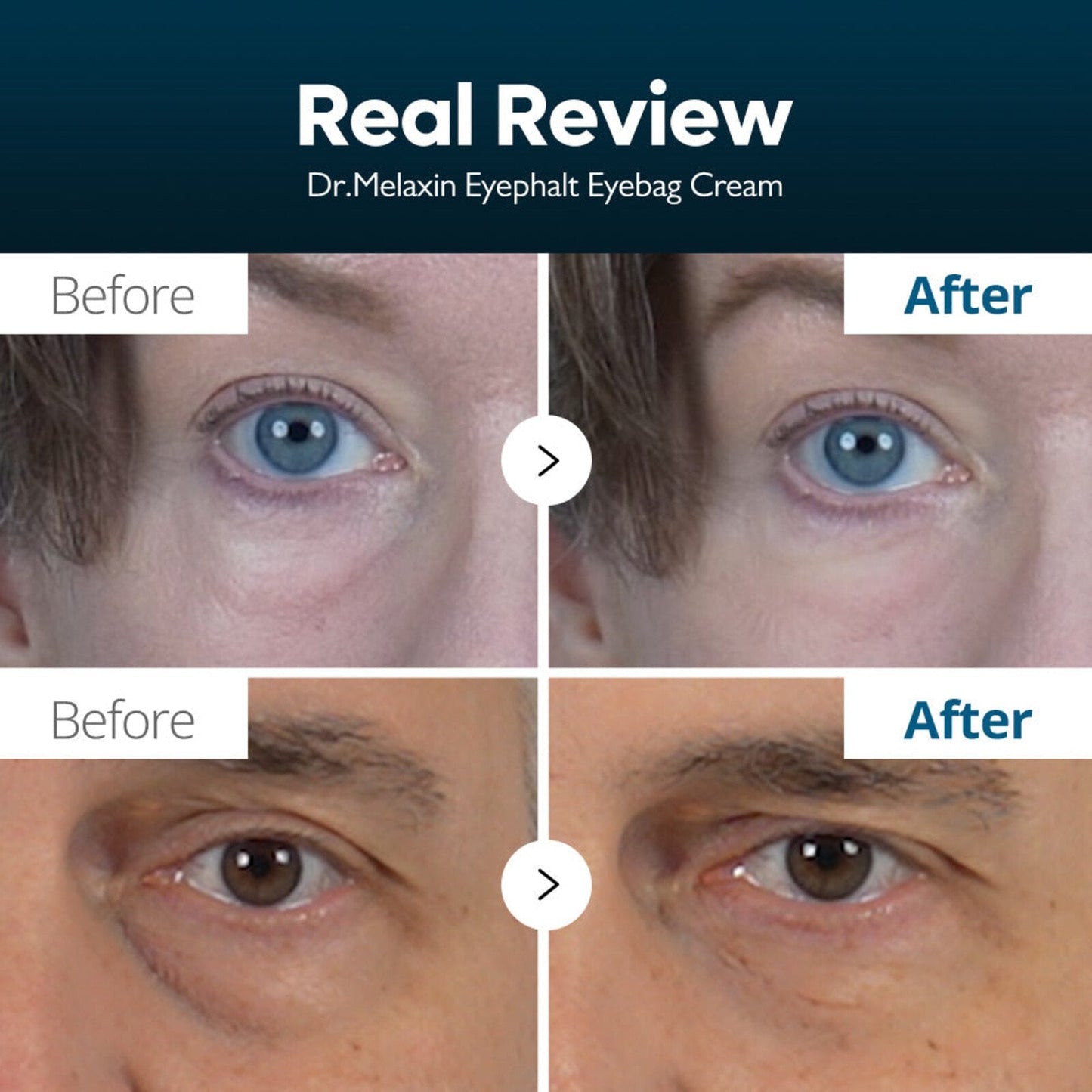 Dr.Melaxin Eyephalt Eye Bag Cream – 10g