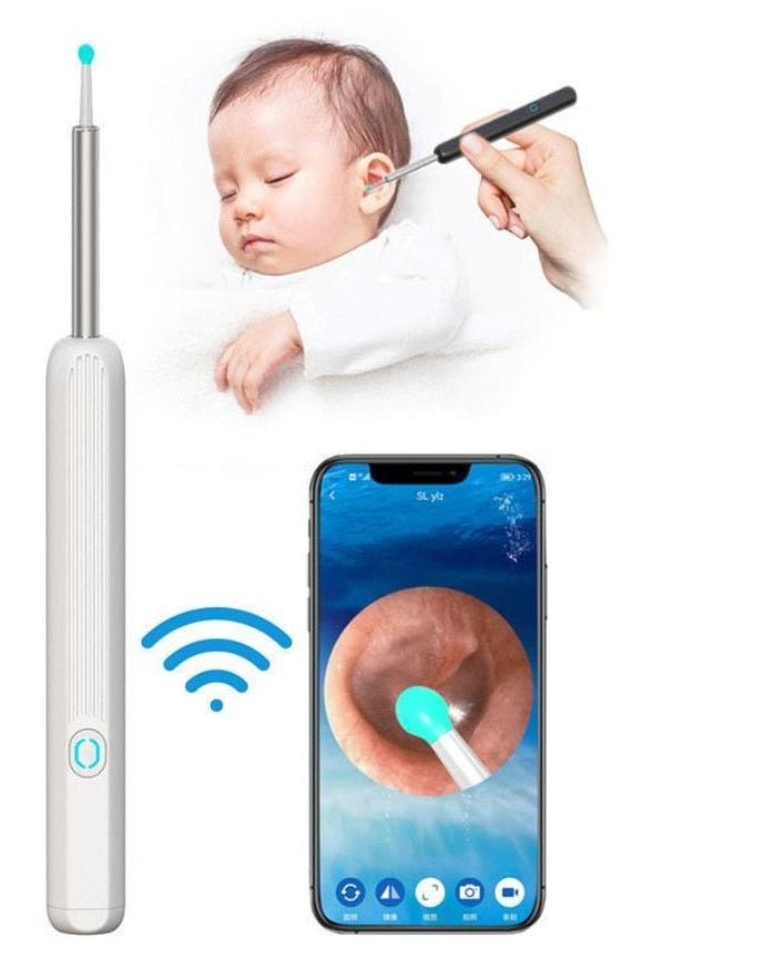 Smart Visual Earwax Removal Kit – HD Camera & Wi-Fi Ear Cleaner