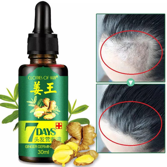 7 Days Hair Growth Germinal Serum Oil – Natural Fast Growth Treatment 30ml