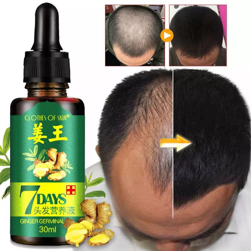 7 Days Hair Growth Germinal Serum Oil – Natural Fast Growth Treatment 30ml