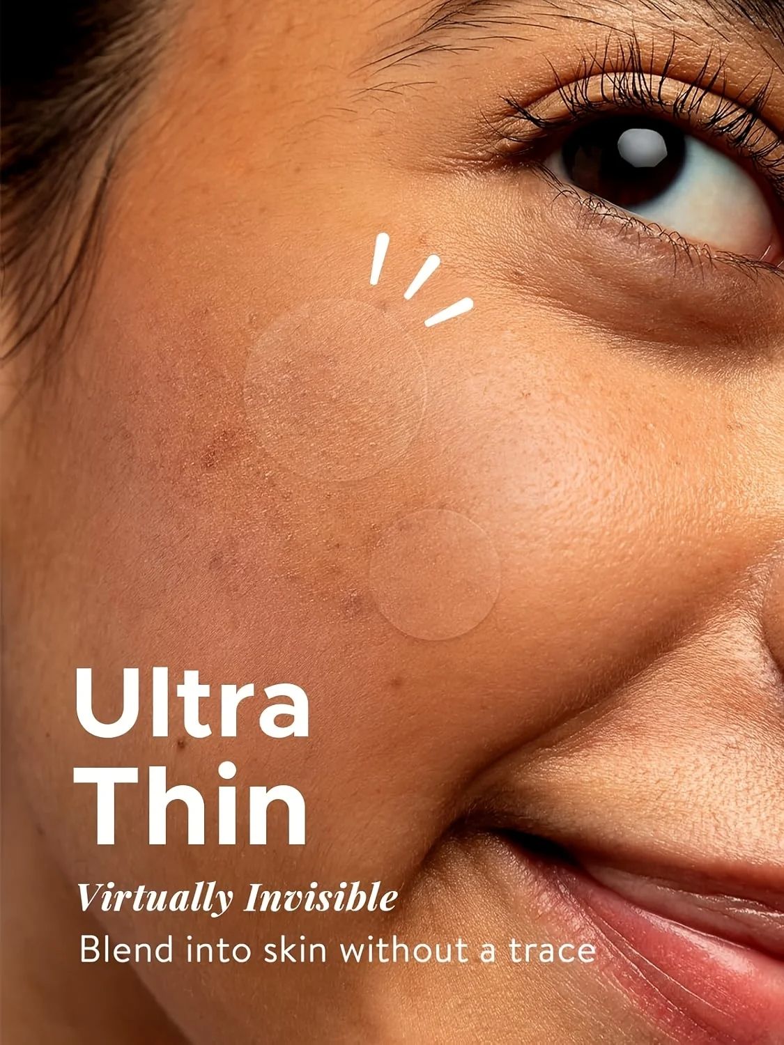 Acne Patches – 360pcs | Pimple Healing Spot Stickers