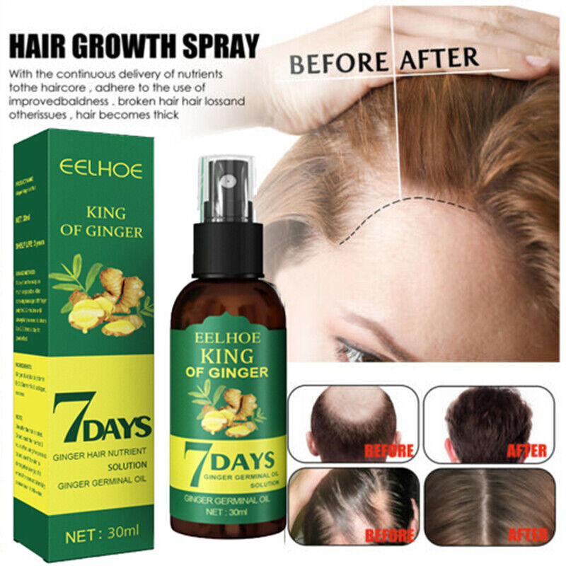 7 Days Hair Growth Germinal Serum Oil – Natural Fast Growth Treatment 30ml