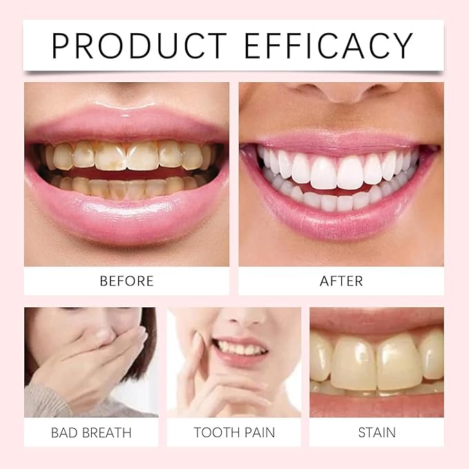Oralhoe Nicotinamide Dazzle White Toothpaste – Vitamin B3 Whitening Gel 100g