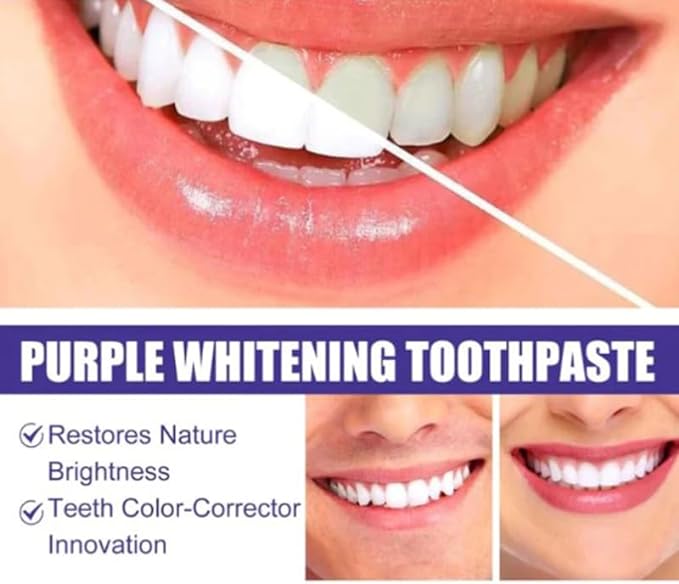 Purple Whitening Toothpaste – Colour Corrector for Instantly Brighter Teeth