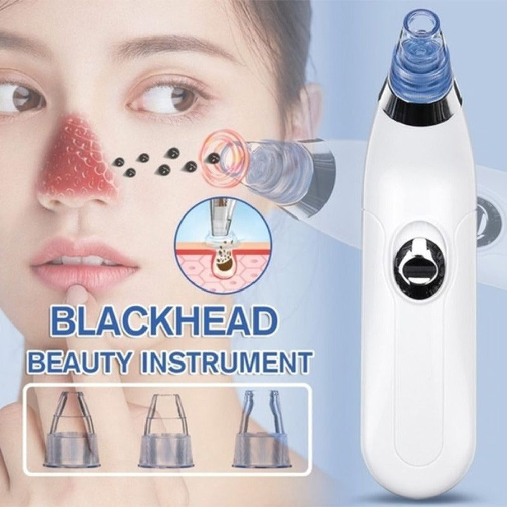 Rechargeable Blackhead Remover Vacuum – Pore Cleaner with LED & 4 Suction Heads