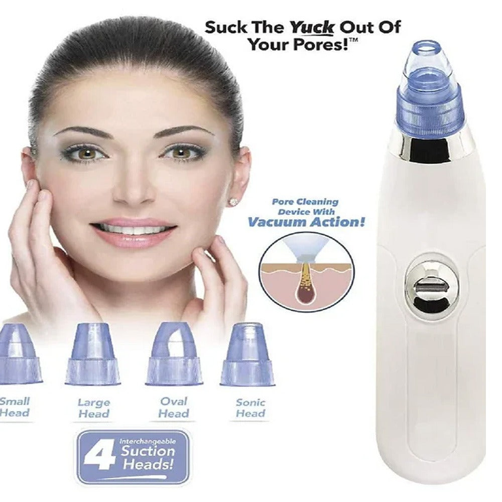 Rechargeable Blackhead Remover Vacuum – Pore Cleaner with LED & 4 Suction Heads
