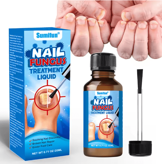 Sumifun Nail Fungus Treatment Liquid – Antifungal Nail Repair Solution 20ml