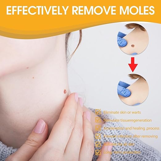 Tag Recede Bee Venom Repair Spray – Wart & Skin Tag Treatment 20ml