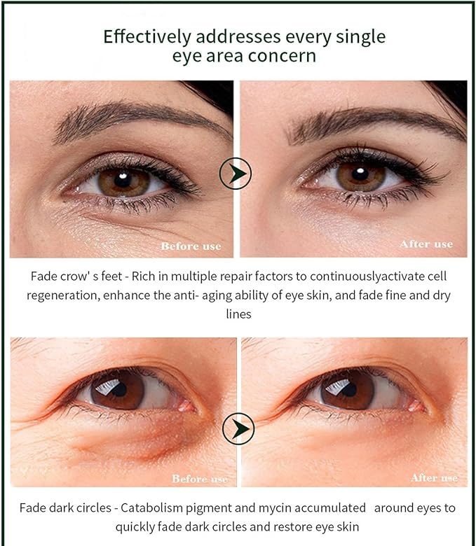 Time Eraser Eye Essence Oil – Anti-Aging Under-Eye Treatment